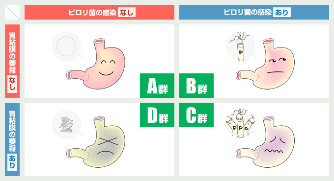 胃がんリスク層別化検査 - つらくない胃カメラ 大腸カメラ｜高崎市 乾